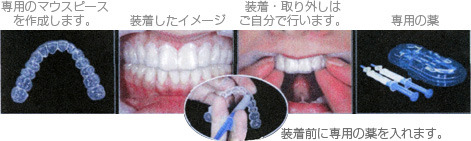 実施の流れ